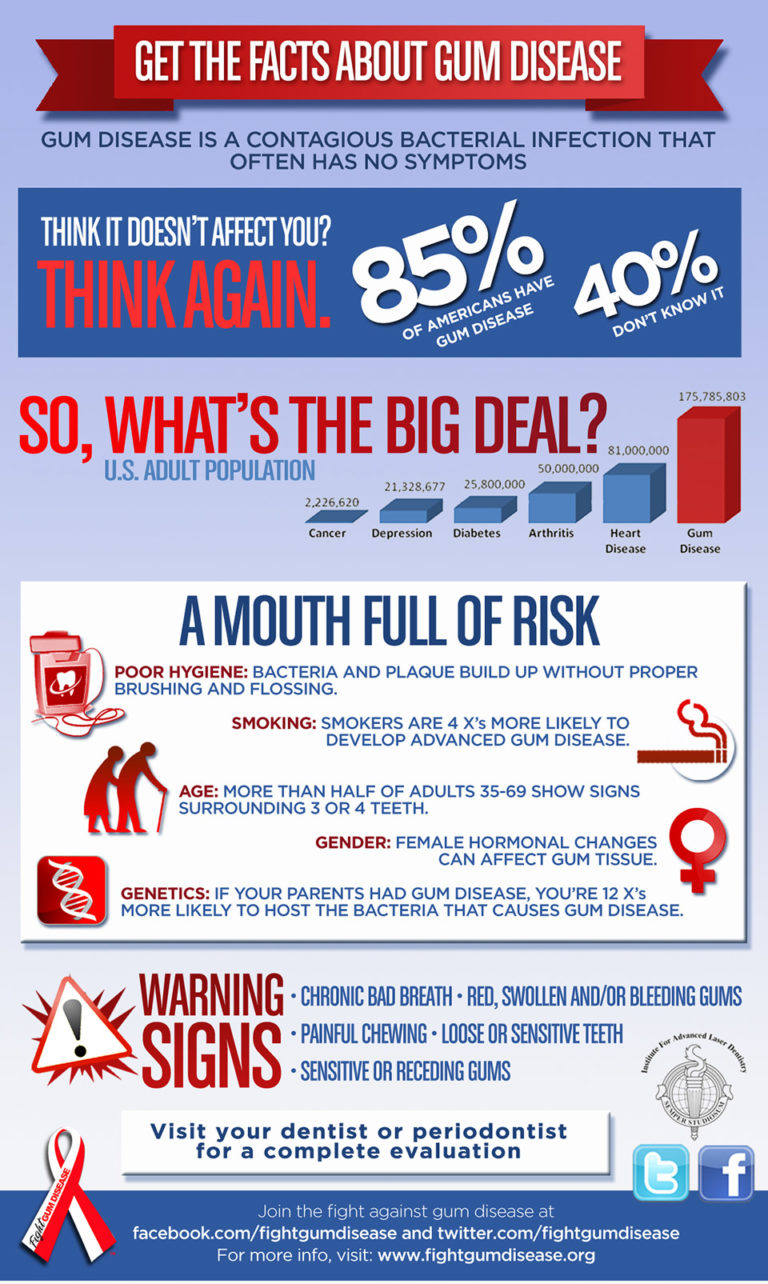 The Surprising Causes of Gum Disease Millennium Dental Technologies, Inc.