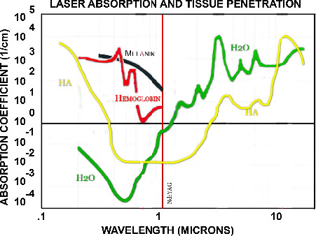 laser-absorption