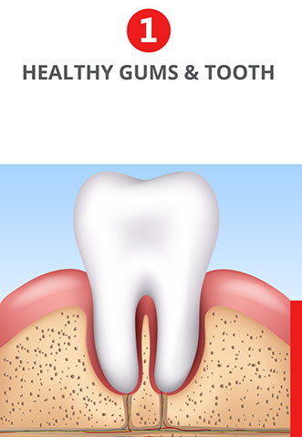Healthy gums and tooth