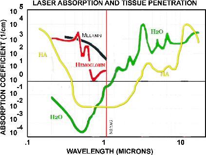 laser-absorption