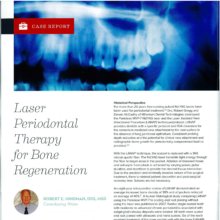 Laser Periodontal Therapy for Bone Regeneration