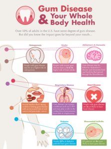 The link between gum disease and your whole body, overall health.