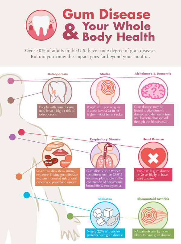 The Surprising Link Between Gum Disease and Systemic Disease