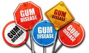 7 Ways to Get Your Community Involved with Gum Disease Awareness Month