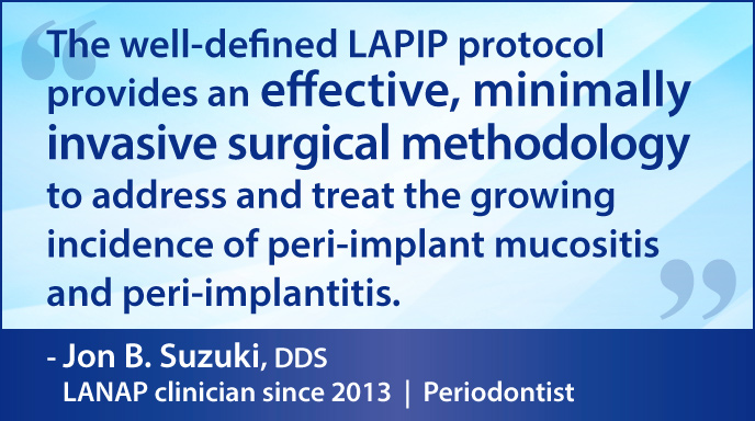 LAPIP protocol - effective, minimally invasive surgical methodology for peri-implant mucositis and peri-implantitis.