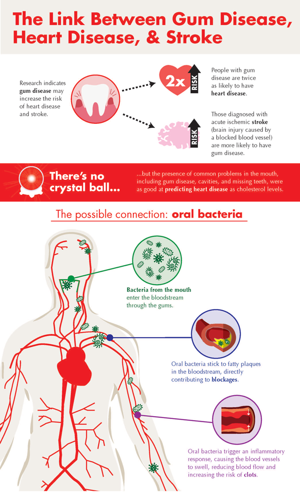 Gum Disease, Heart Disease & Stroke