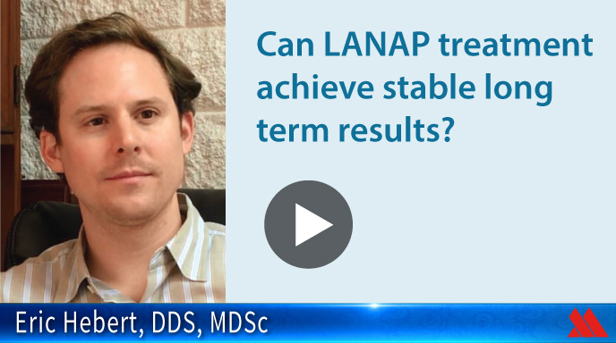 Can LANAP treatment achieve stable long term results?