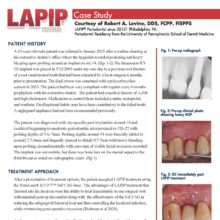 LAPIP Case Study, Courtesy of Robert A. Levine, DDS