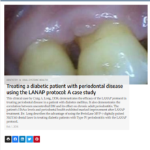 Treating a diabetic patient with the LANAP protocol